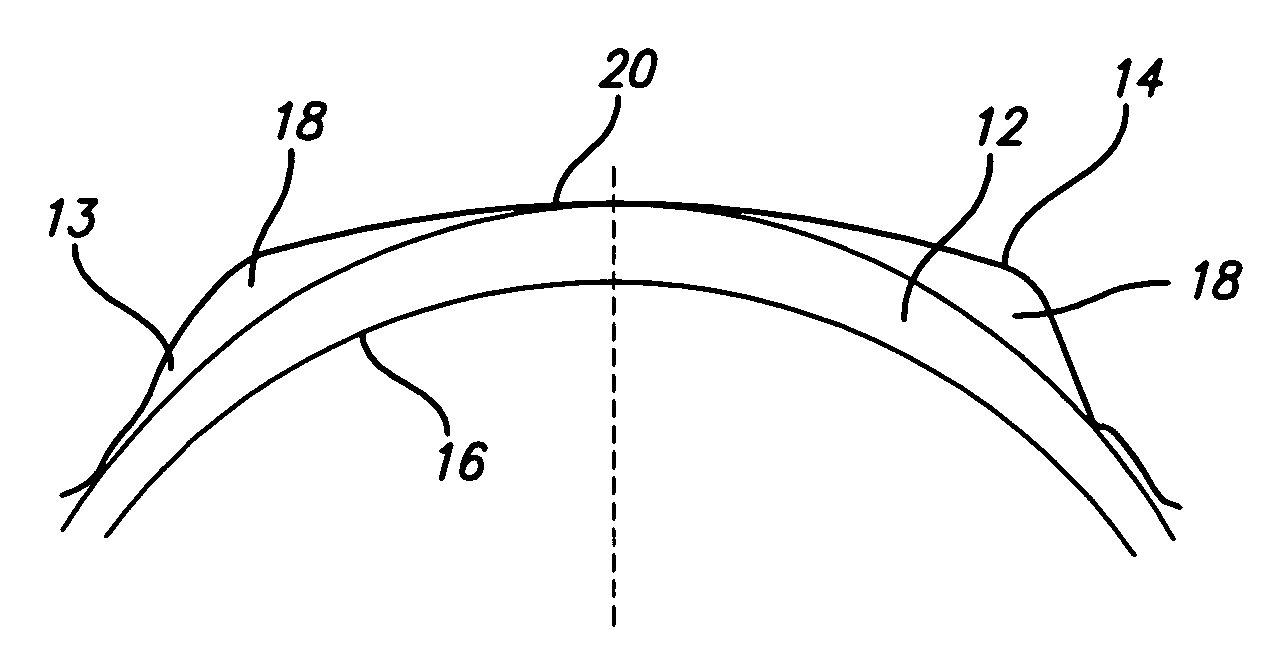 Orthokeratological contact lenses and design methods therefor