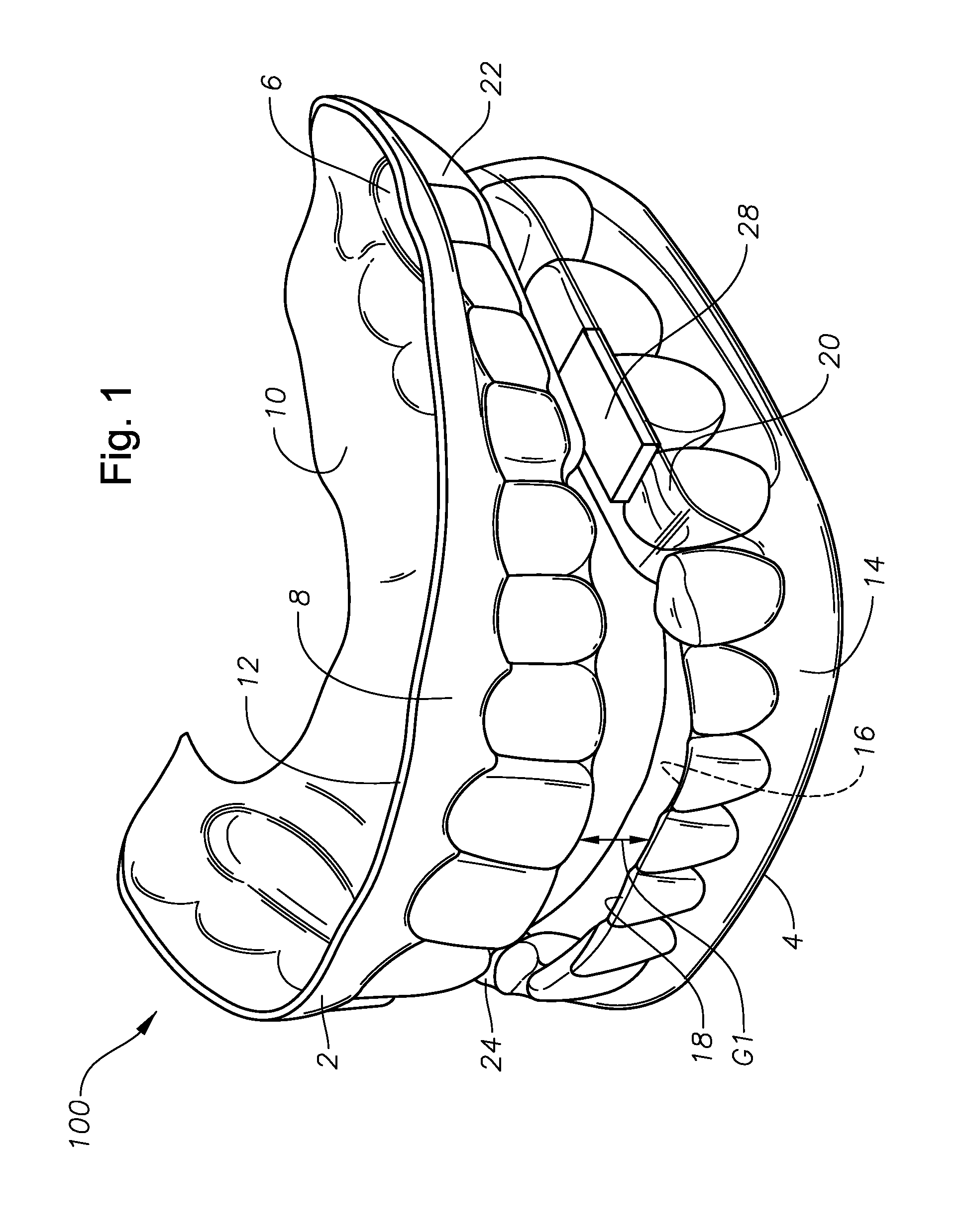 Oral devices, kits, and methods for reducing sleep apnea, snoring, and/or nasal drainage