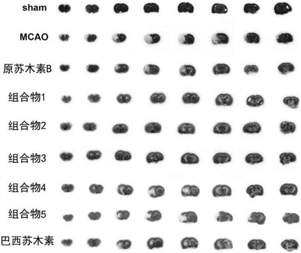 Composition for treating ischemic cerebral apoplexy, and preparation method and medical application thereof