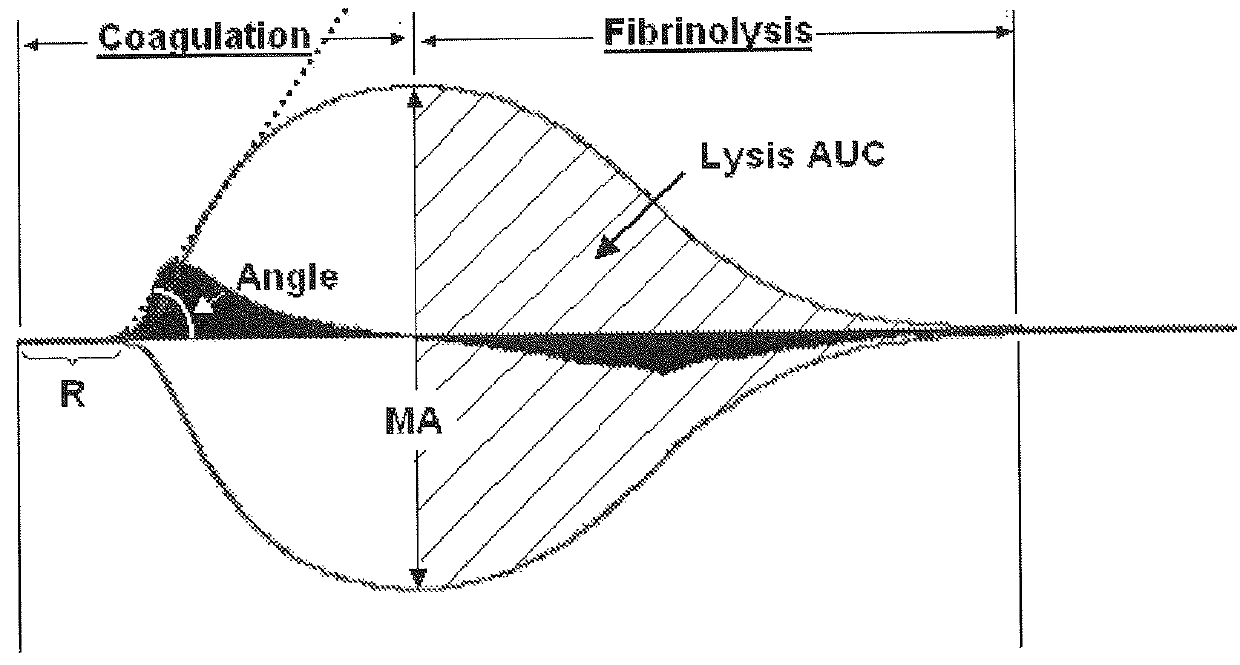 Systemic pro-hemostatic effect of sympathicomimetics with agonistic effects on alfa-adrenergic and/or beta-adrenergic receptors of the sympathetic nervous system, related to improved clot strength