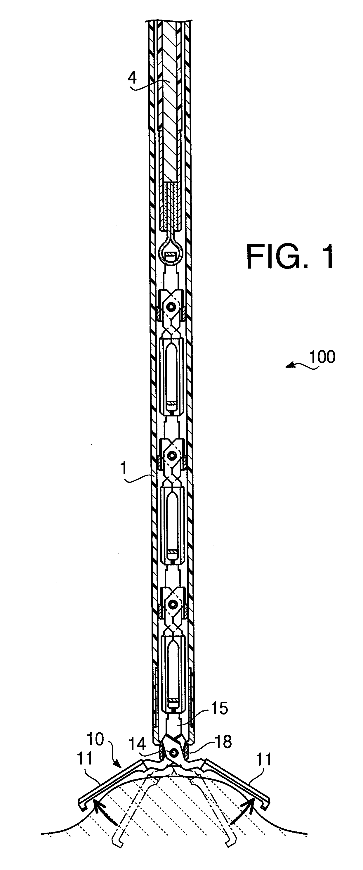 Clipping instrument for an endoscopic surgical device