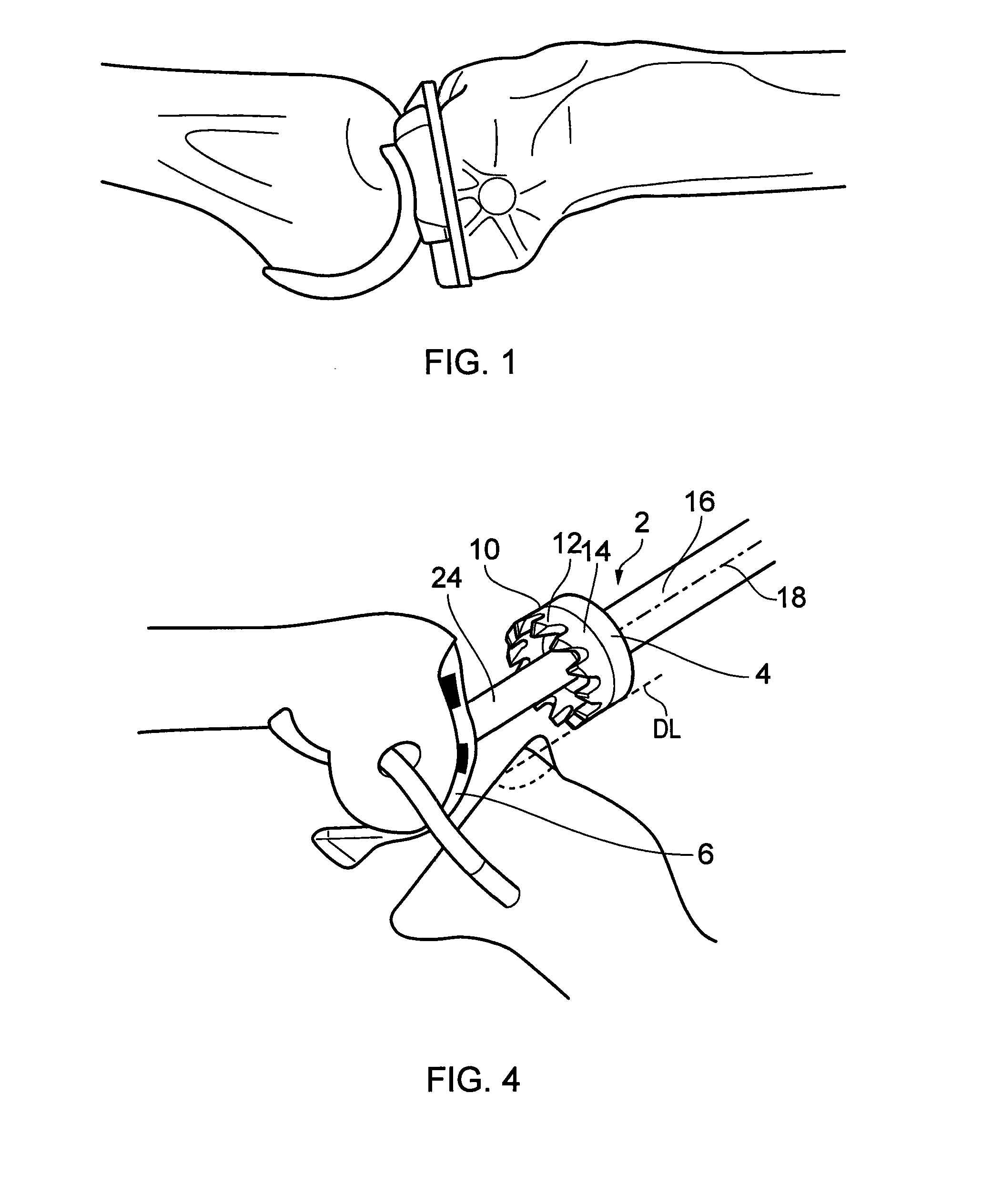 Rotary mill