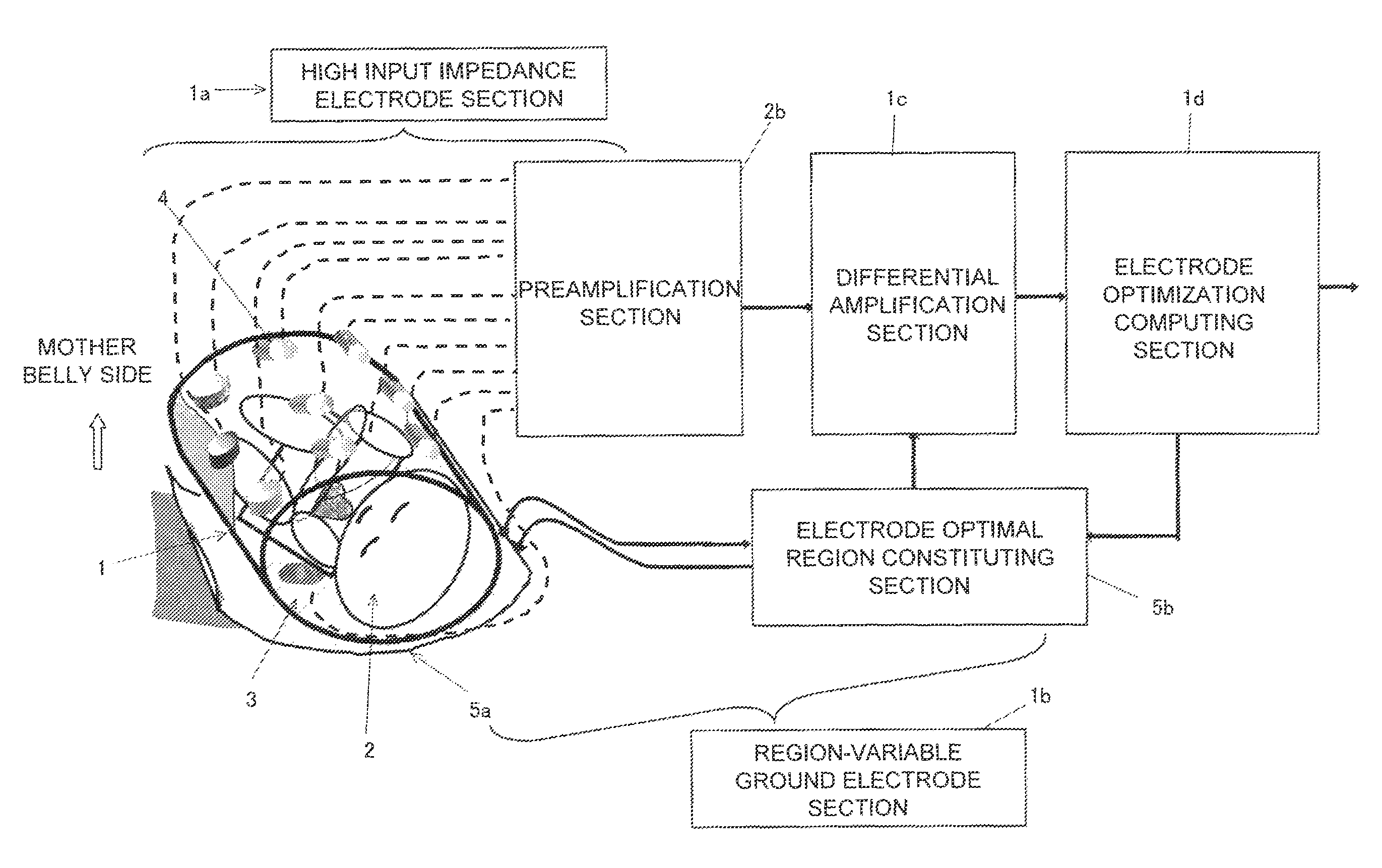 Fetus electrocardiogram signal measuring method and its device