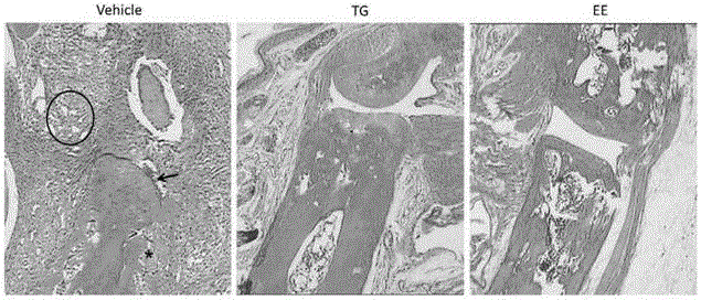 Application of eleutheroside e in preparation of medicine for treating rheumatoid arthritis