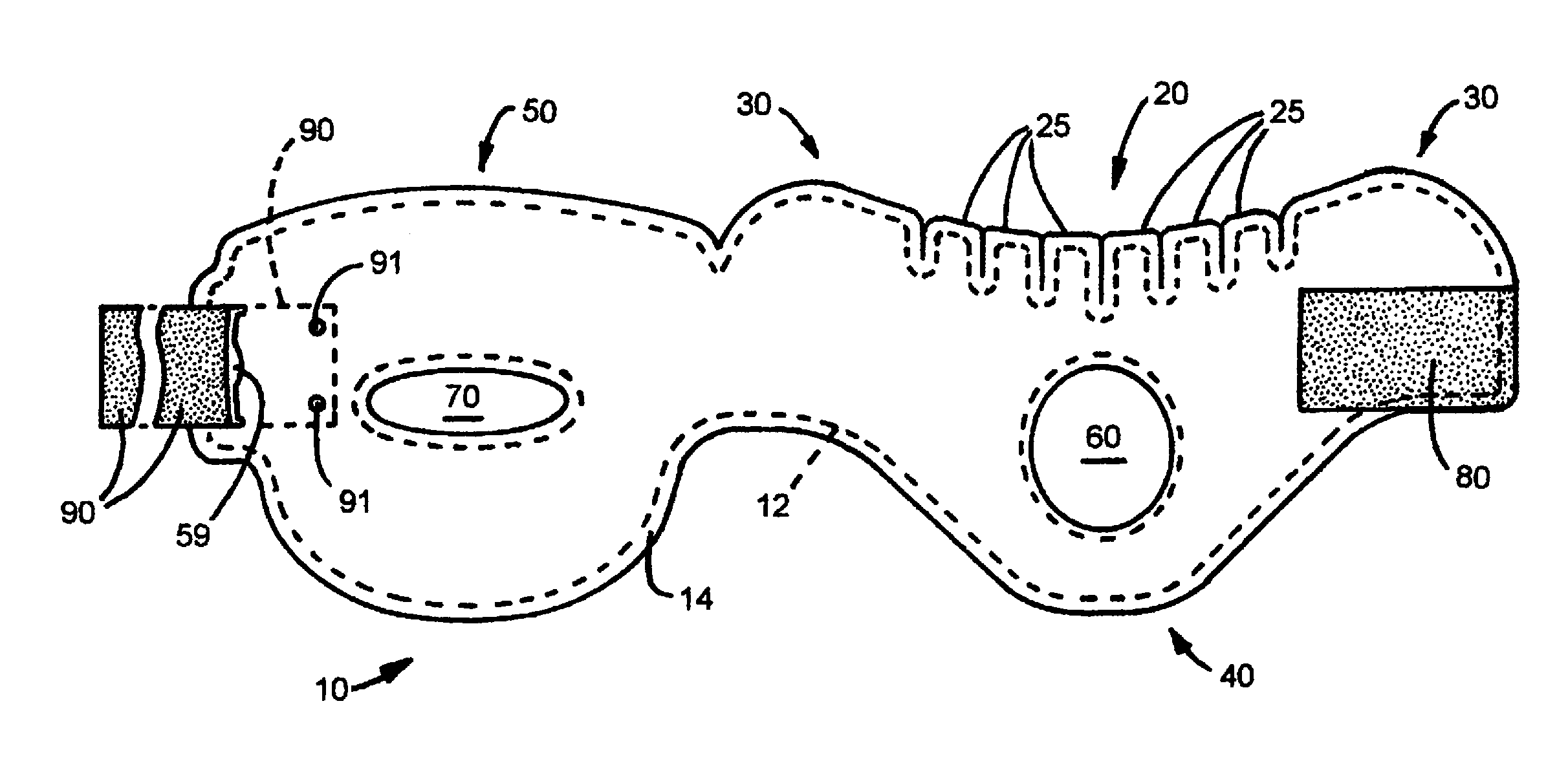 Conformable cervical collar