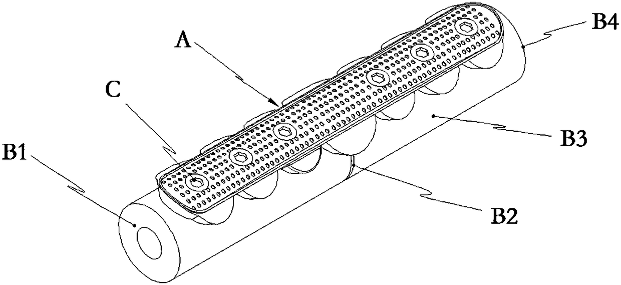 Magnesium alloy tibial fracture bone plate