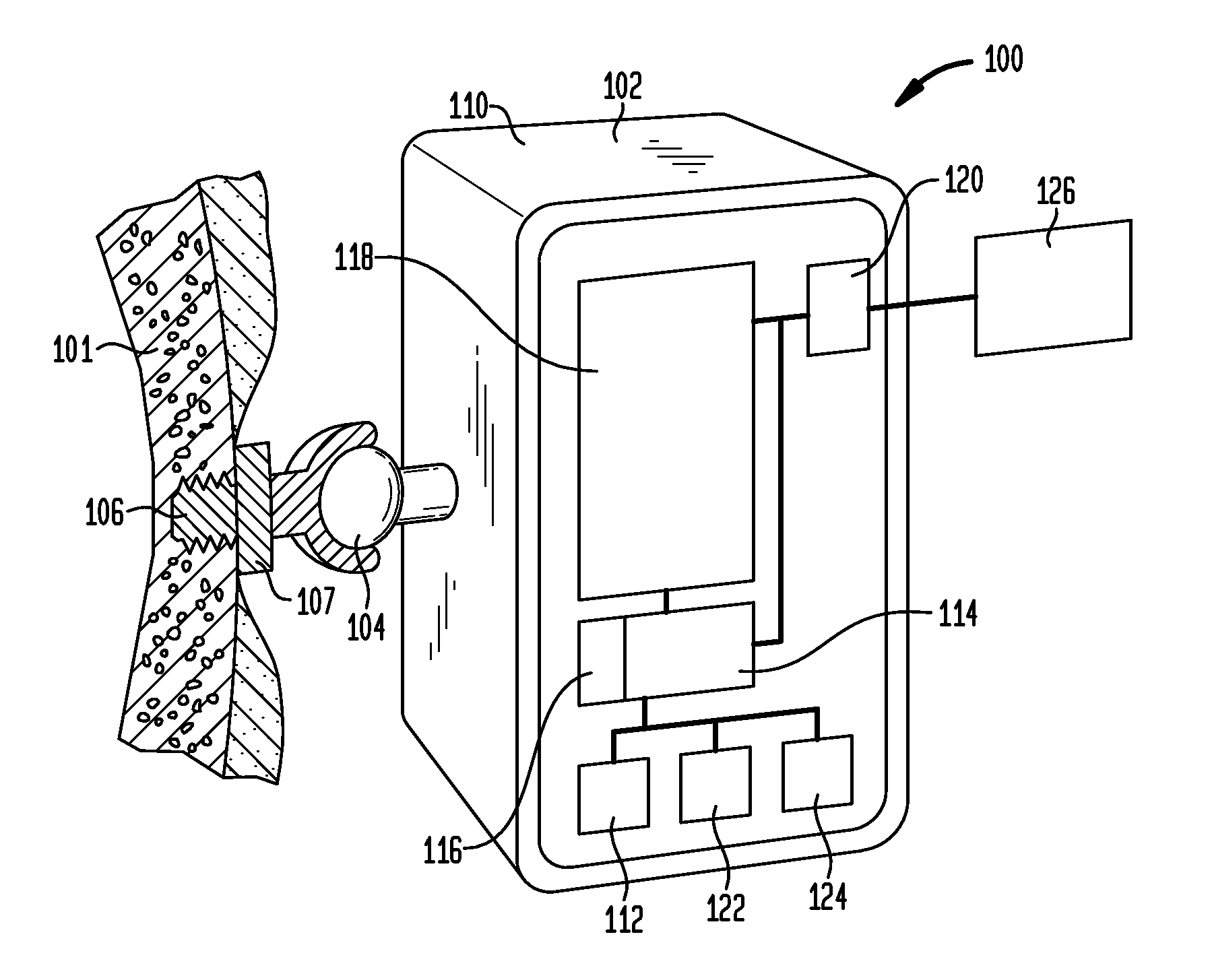 Customization of bone conduction hearing devices