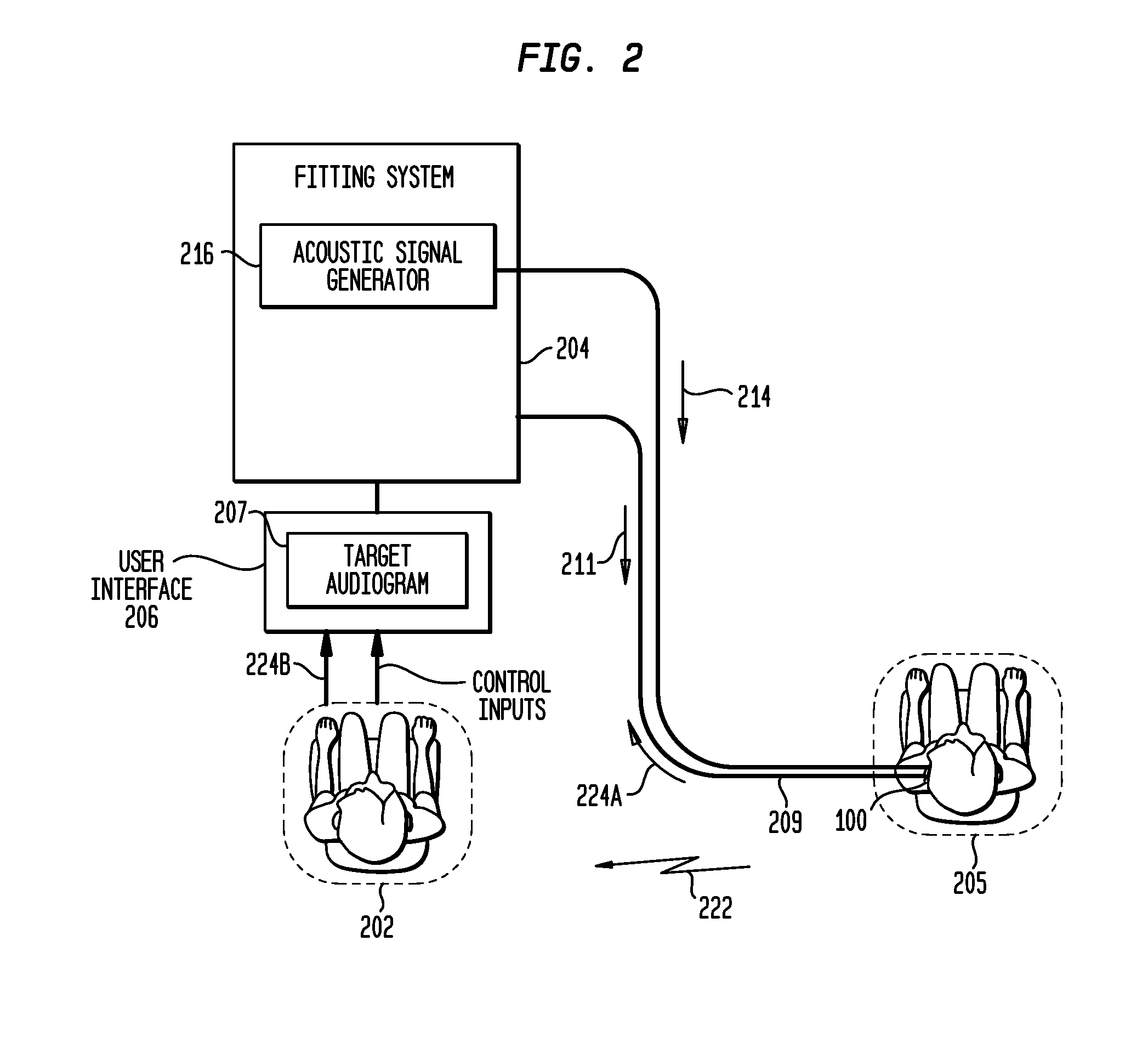 Customization of bone conduction hearing devices