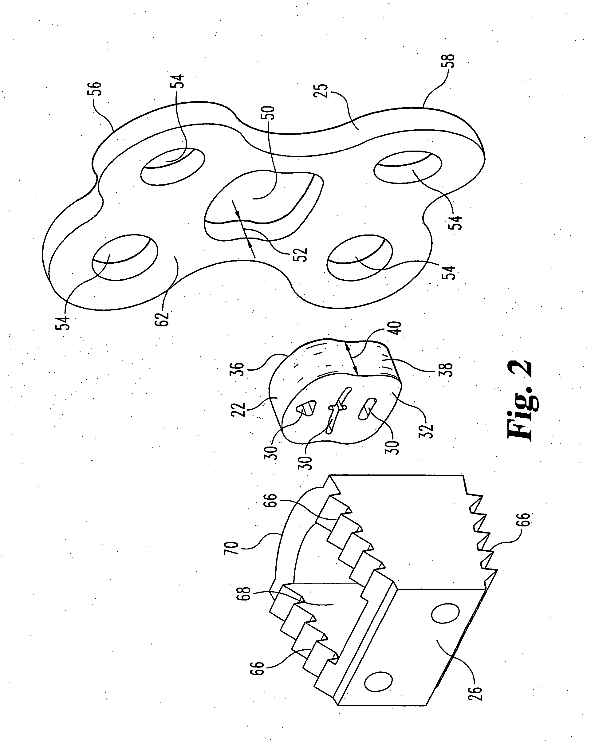 Orthopedic support locating or centering feature and method