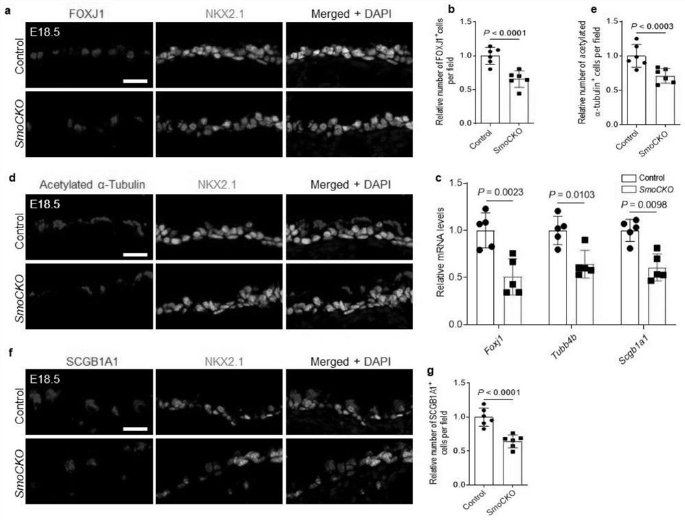 Application of Hedgehog signal channel gene and regulator in regulating physiological functions of airway epithelial cells