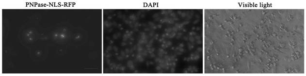 Bacterial-derived anti-tumor PNPase gene as well as preparation method and application thereof