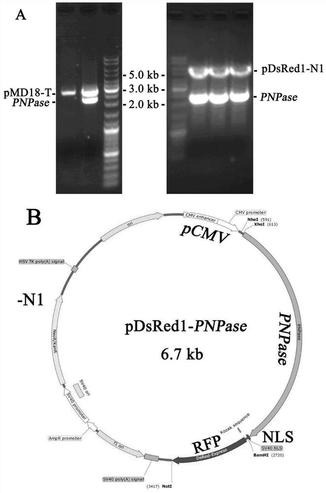 Bacterial-derived anti-tumor PNPase gene as well as preparation method and application thereof