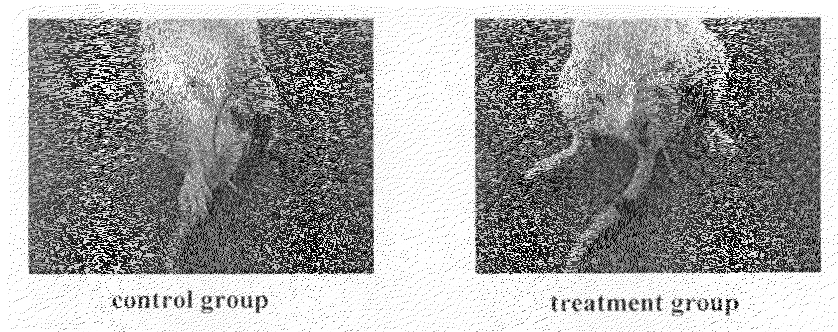 Cell preparation containing multipotential stem cells originating in fat tissue