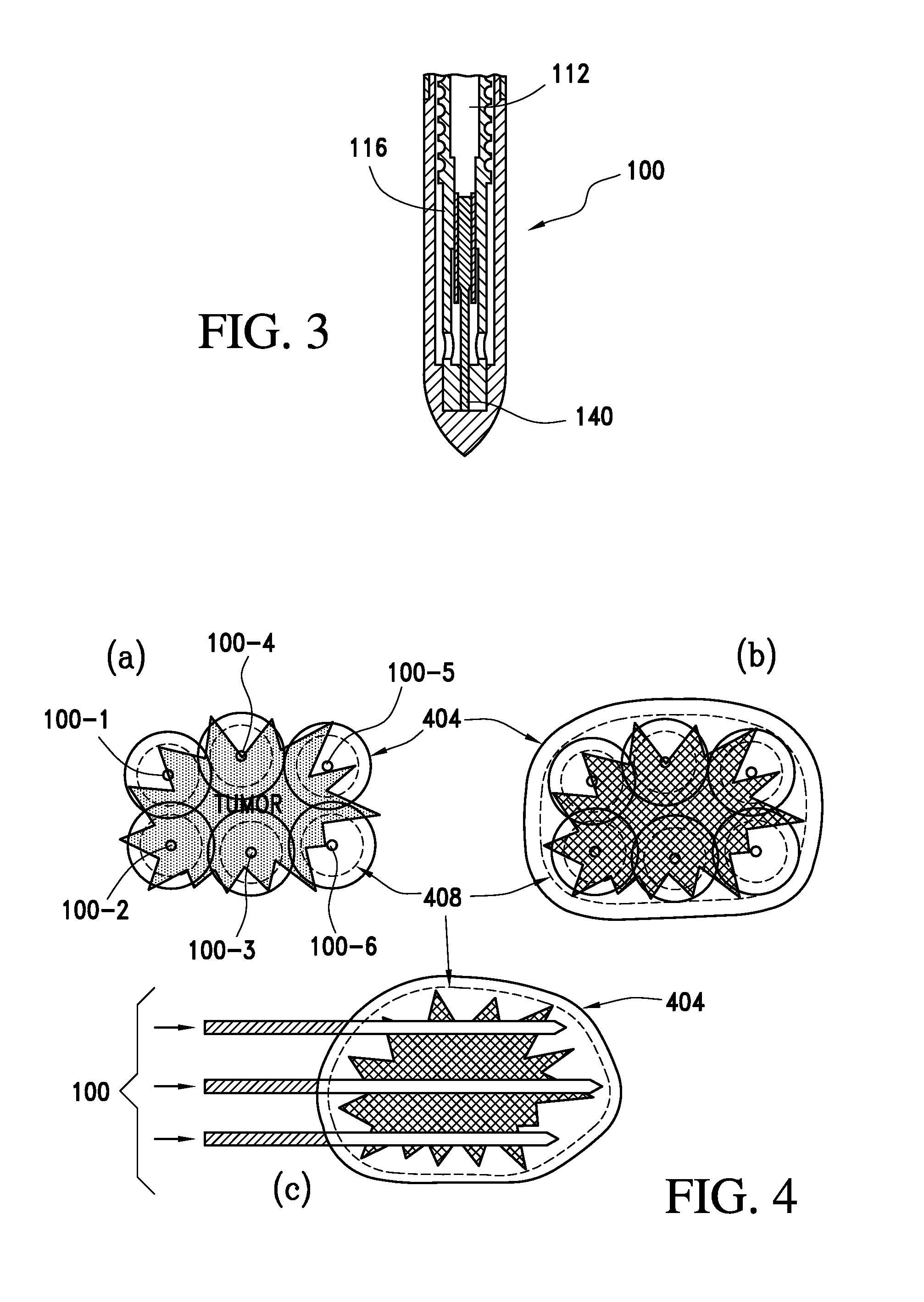 Cryotherapy probe