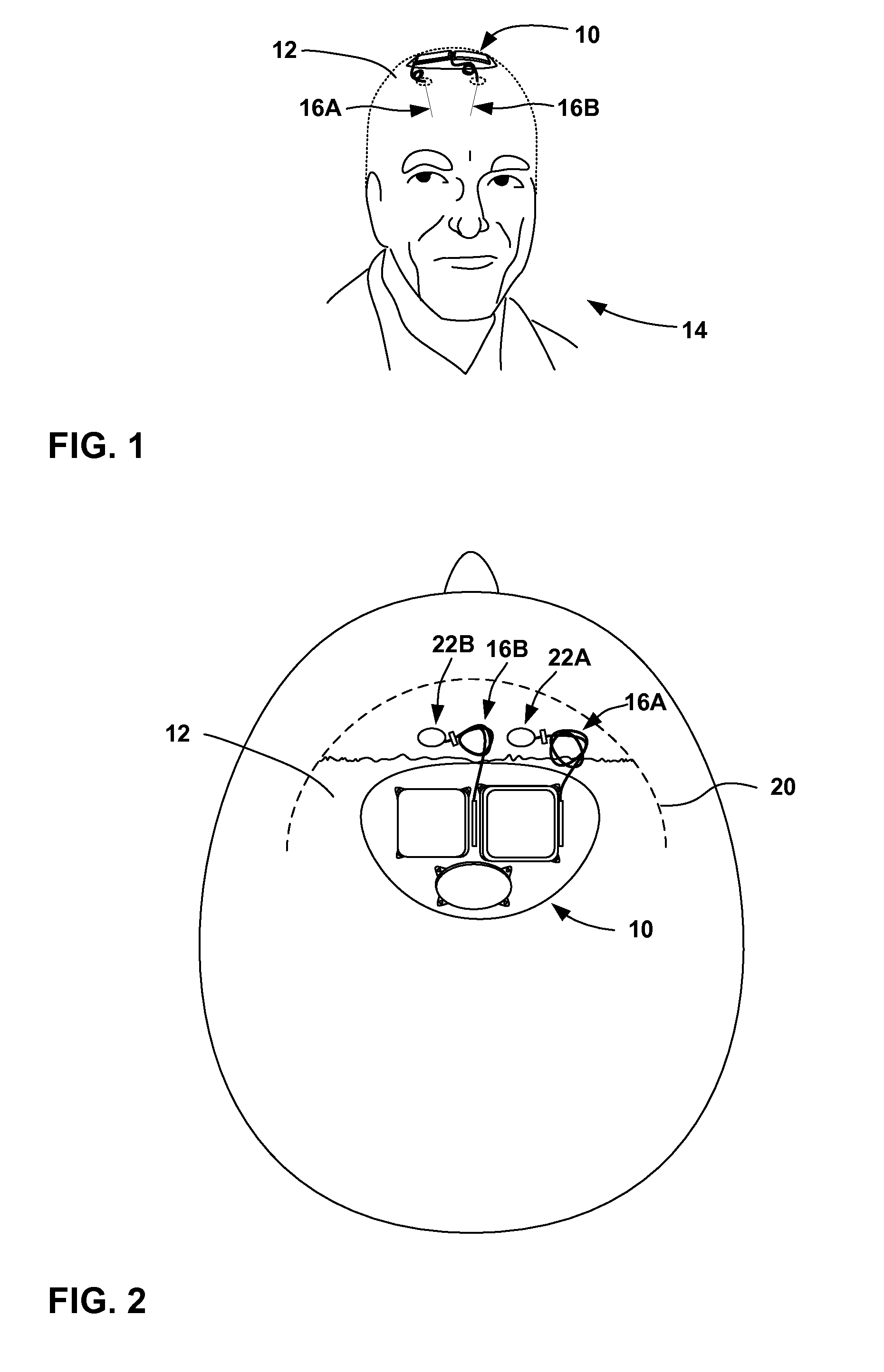 Implantable medical device with a nonhermetic battery