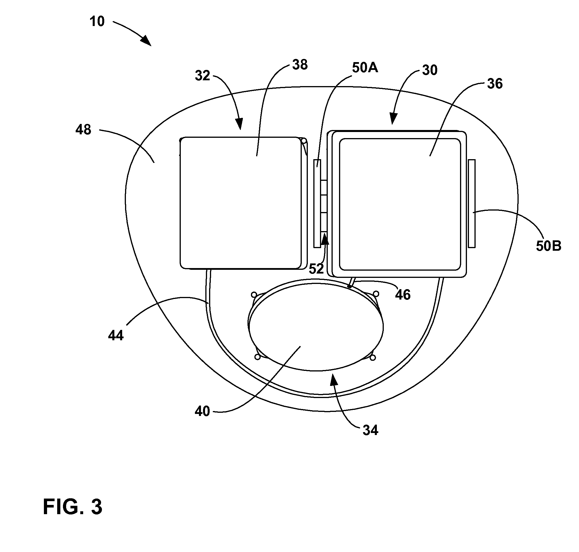 Implantable medical device with a nonhermetic battery