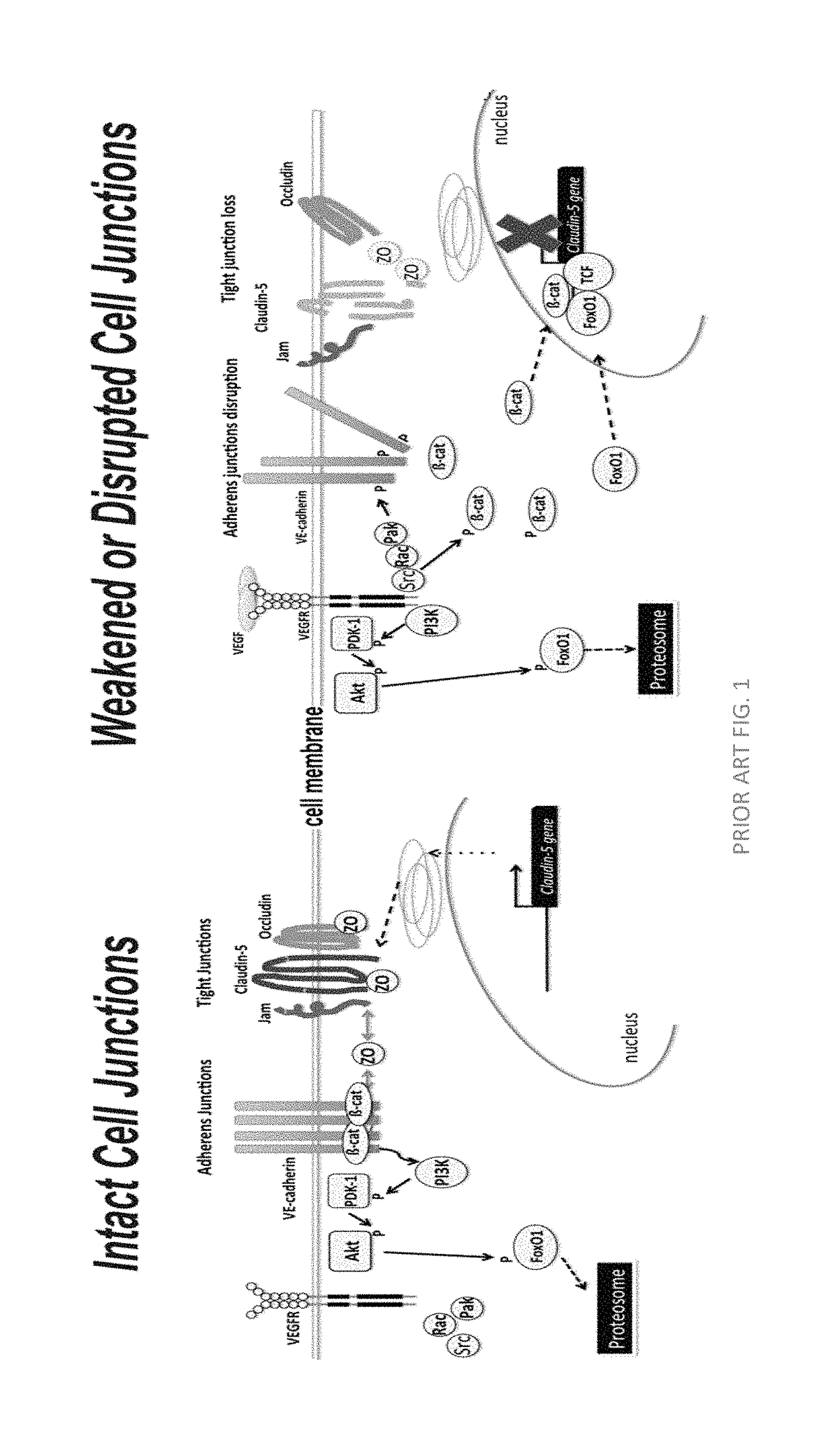 Norrin regulation of cellular production of junction proteins and use to treat retinal vasculature edema