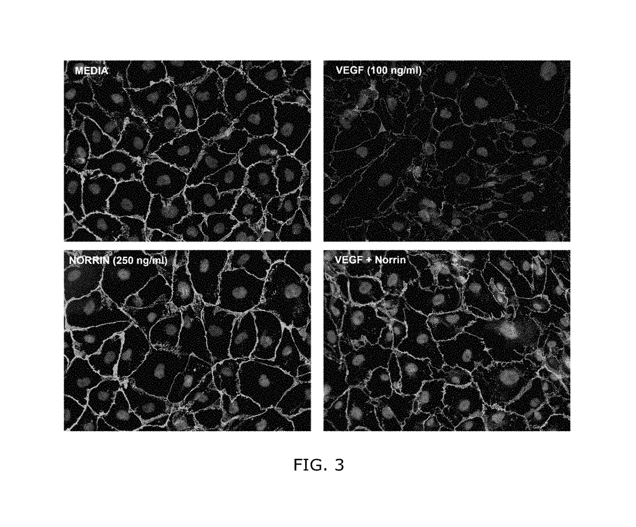 Norrin regulation of cellular production of junction proteins and use to treat retinal vasculature edema