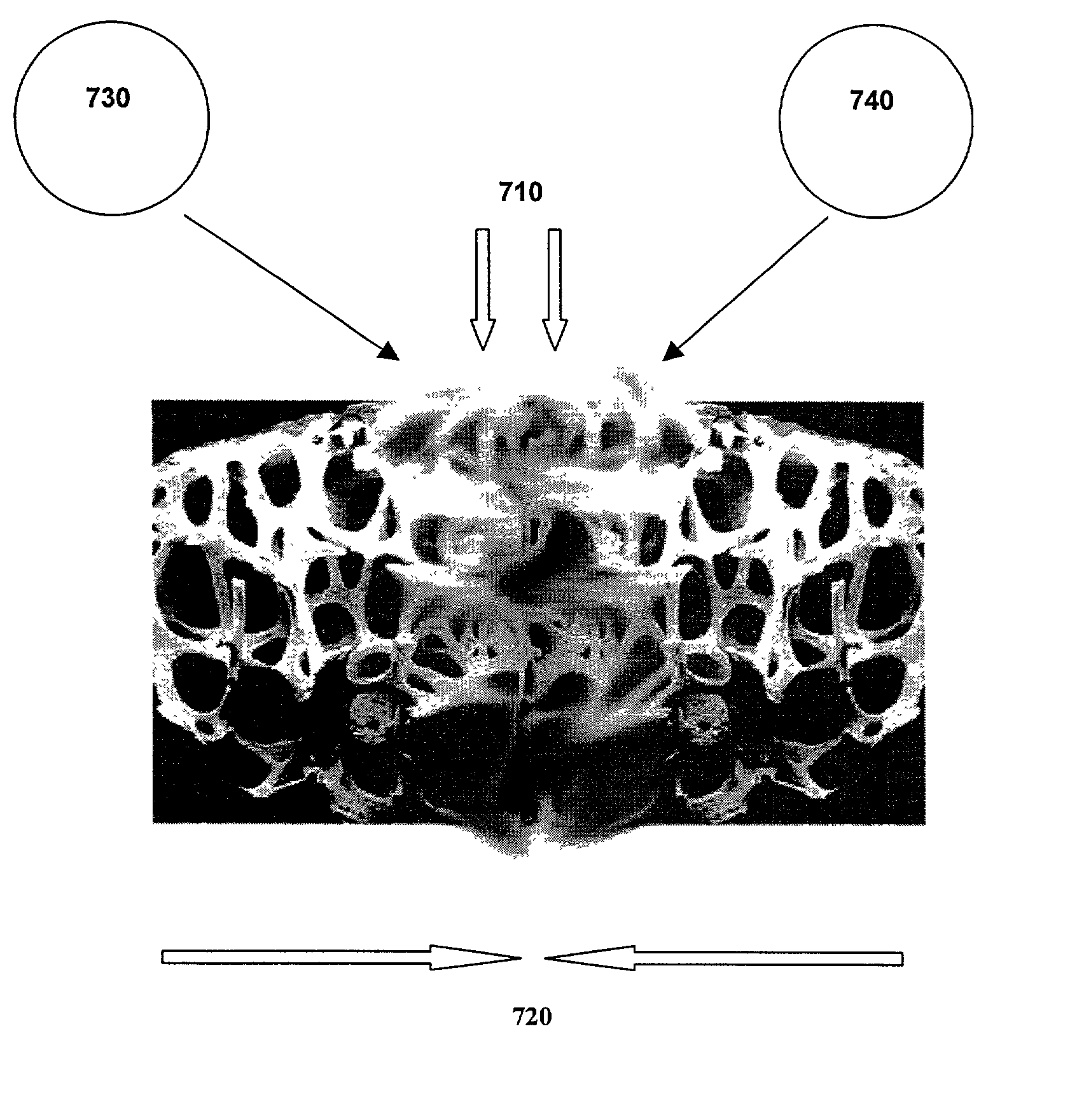 Method for fusing bone during endoscopy procedures