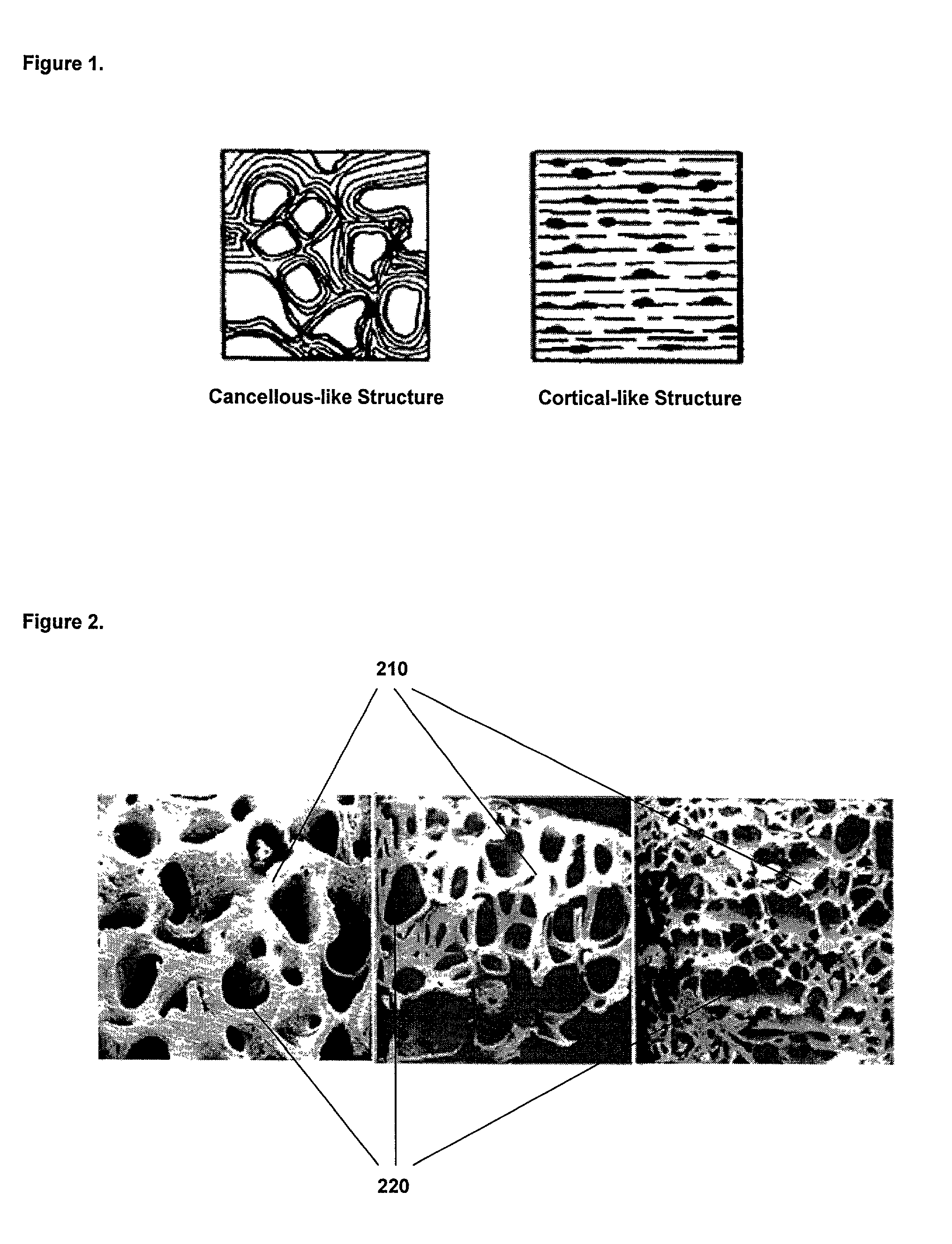 Method for fusing bone during endoscopy procedures