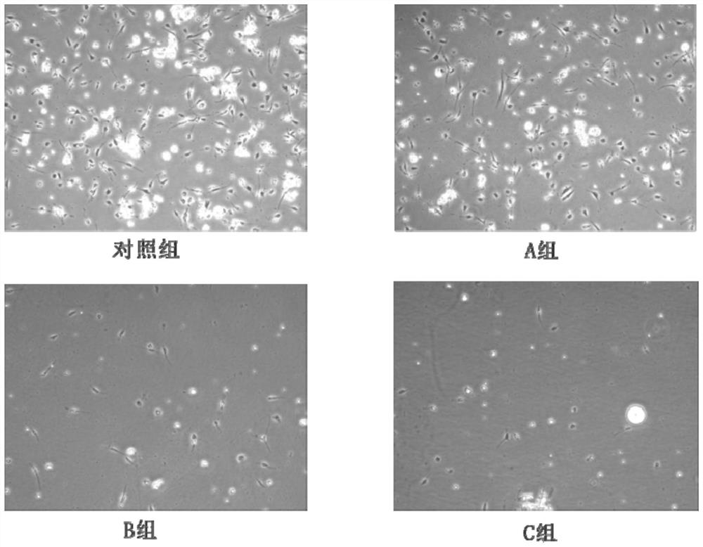 A fat graft enriched with highly active fat granule cells and adipose stem cells, its preparation method and application