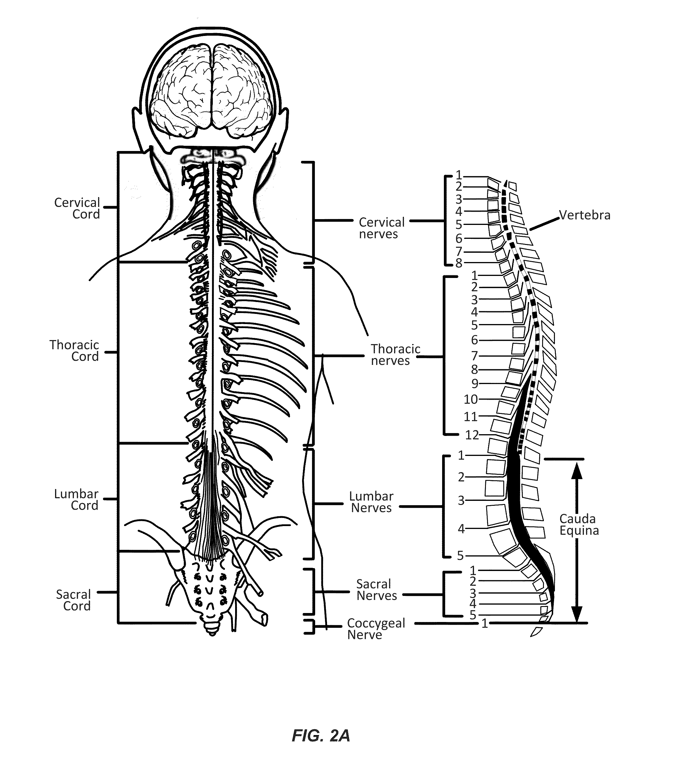 Electromyographic Lead Positioning and Stimulation Titration in a Nerve Stimulation System for Treatment of Overactive Bladder