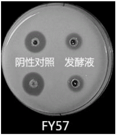 Streptomyces antibioticus FY57 and application thereof in preparation of trypsin inhibitor