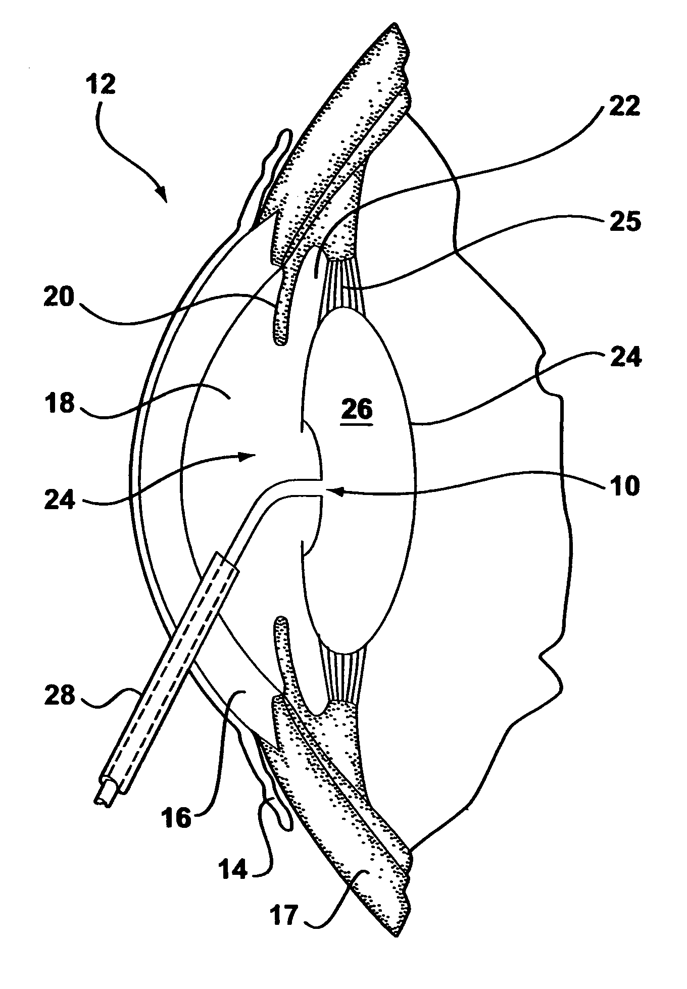 Apparatus and methods for isolating lens capsule fluids