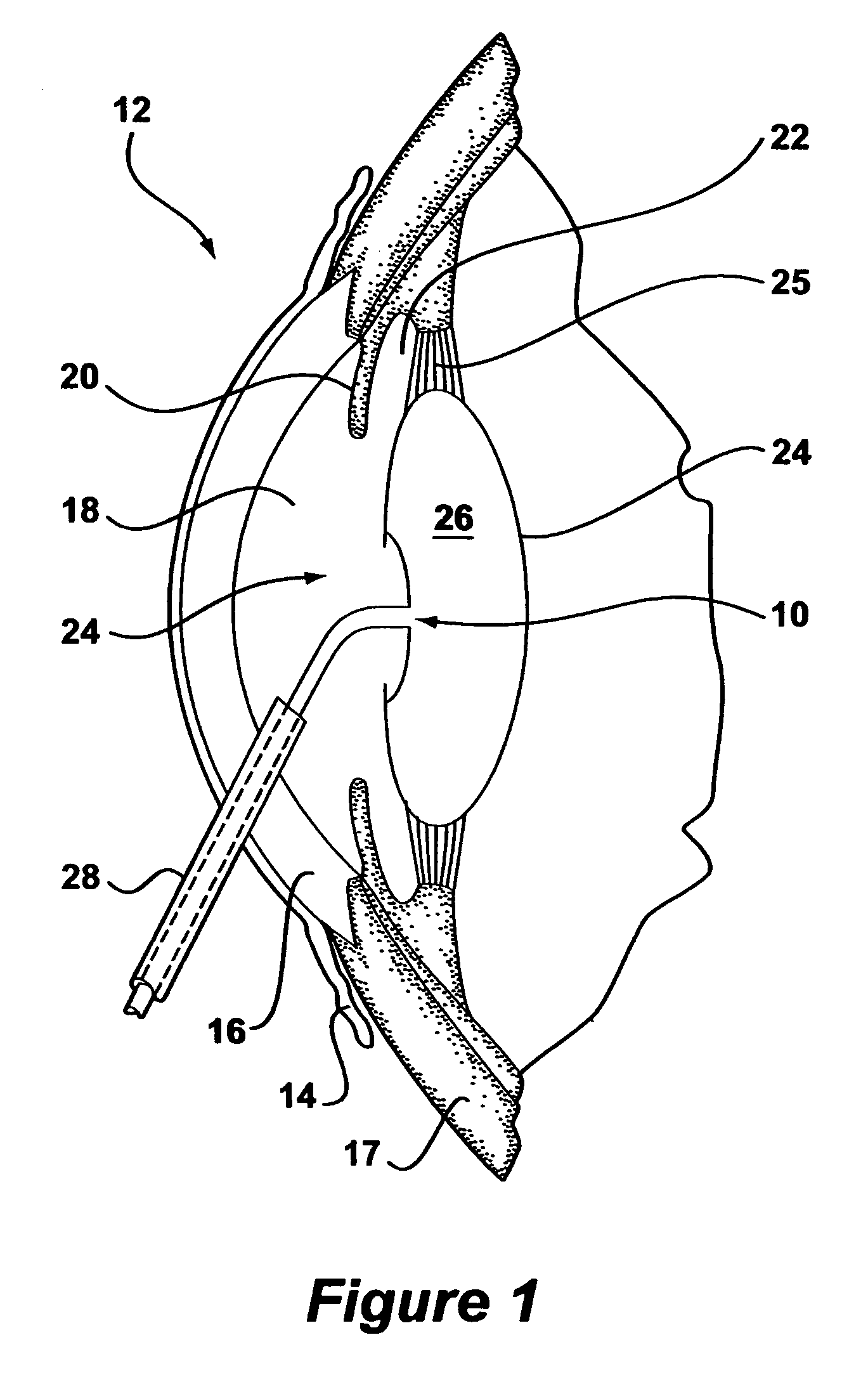 Apparatus and methods for isolating lens capsule fluids