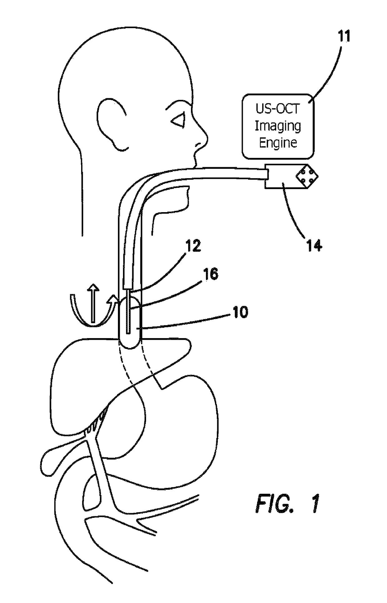 Integrated ultrasound, OCT, PA and/or florescence imaging endoscope for diagnosing cancers in gastrointestinal, respiratory, and urogenital tracts