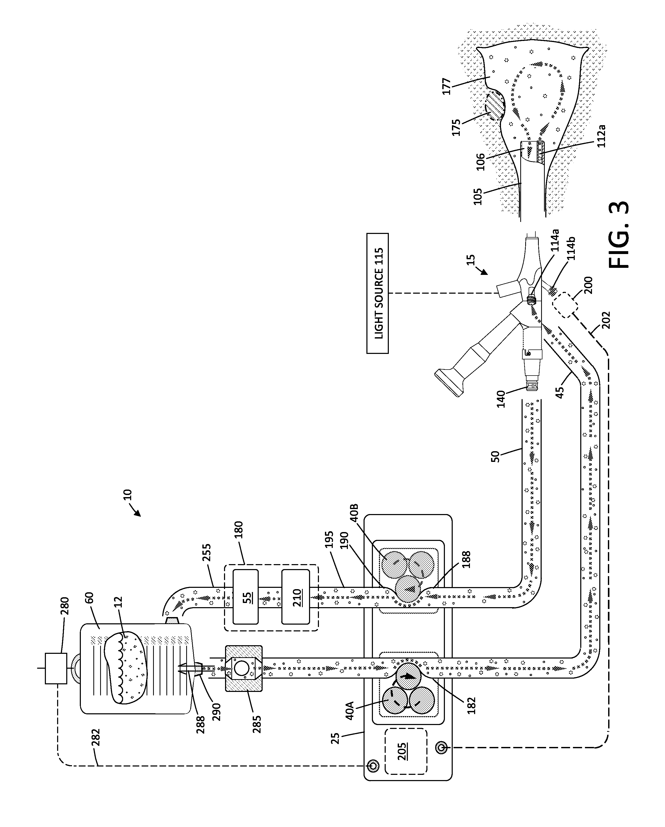 Fluid management system and methods