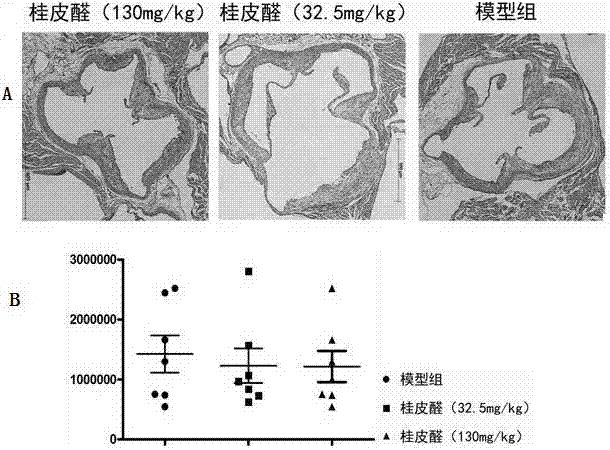 Application of cinnamaldehyde in preparing medicine for treating atherosclerosis