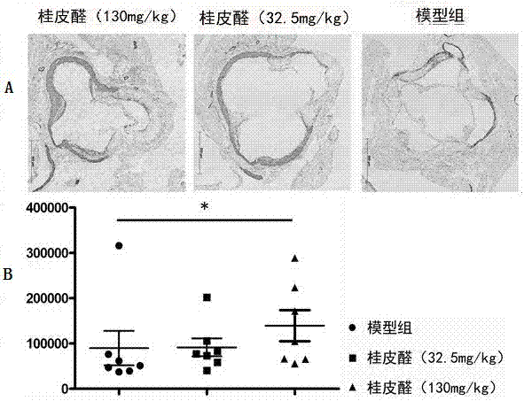 Application of cinnamaldehyde in preparing medicine for treating atherosclerosis