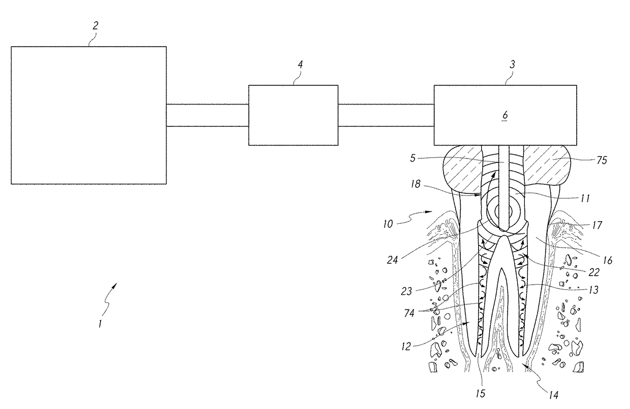 Apparatus and methods for filling teeth and root canals