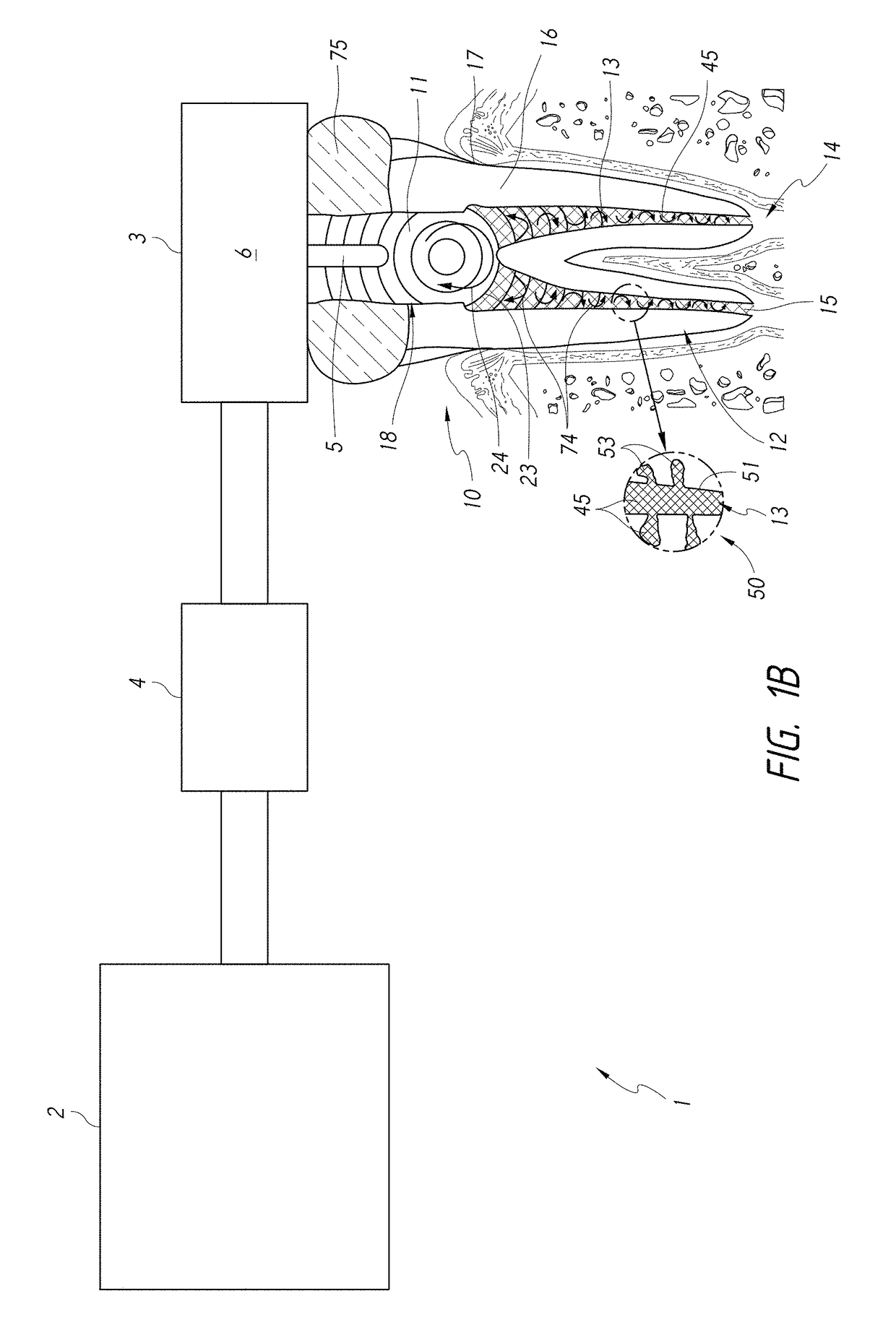 Apparatus and methods for filling teeth and root canals