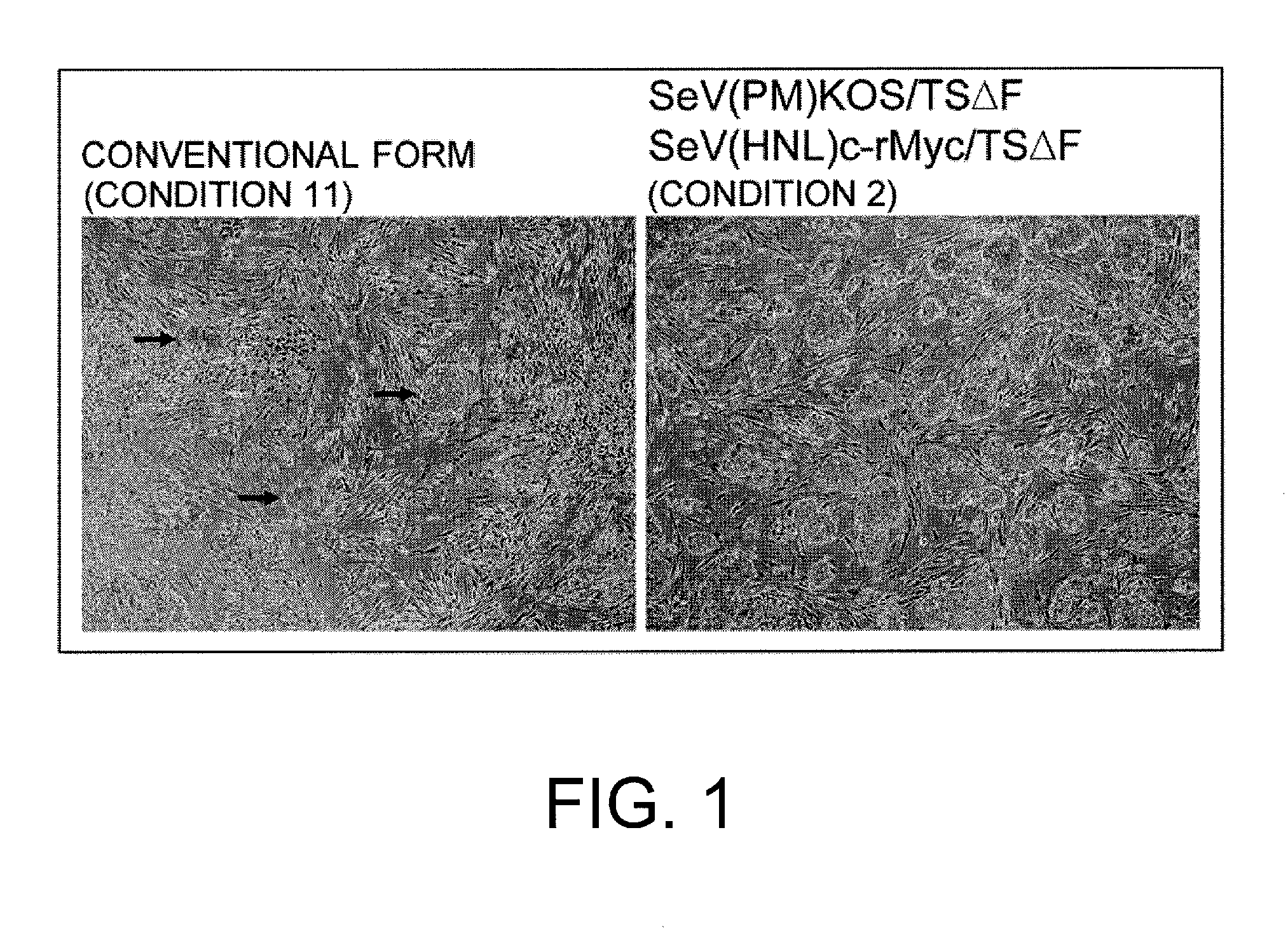 Composition for inducing pluripotent stem cell, and use thereof