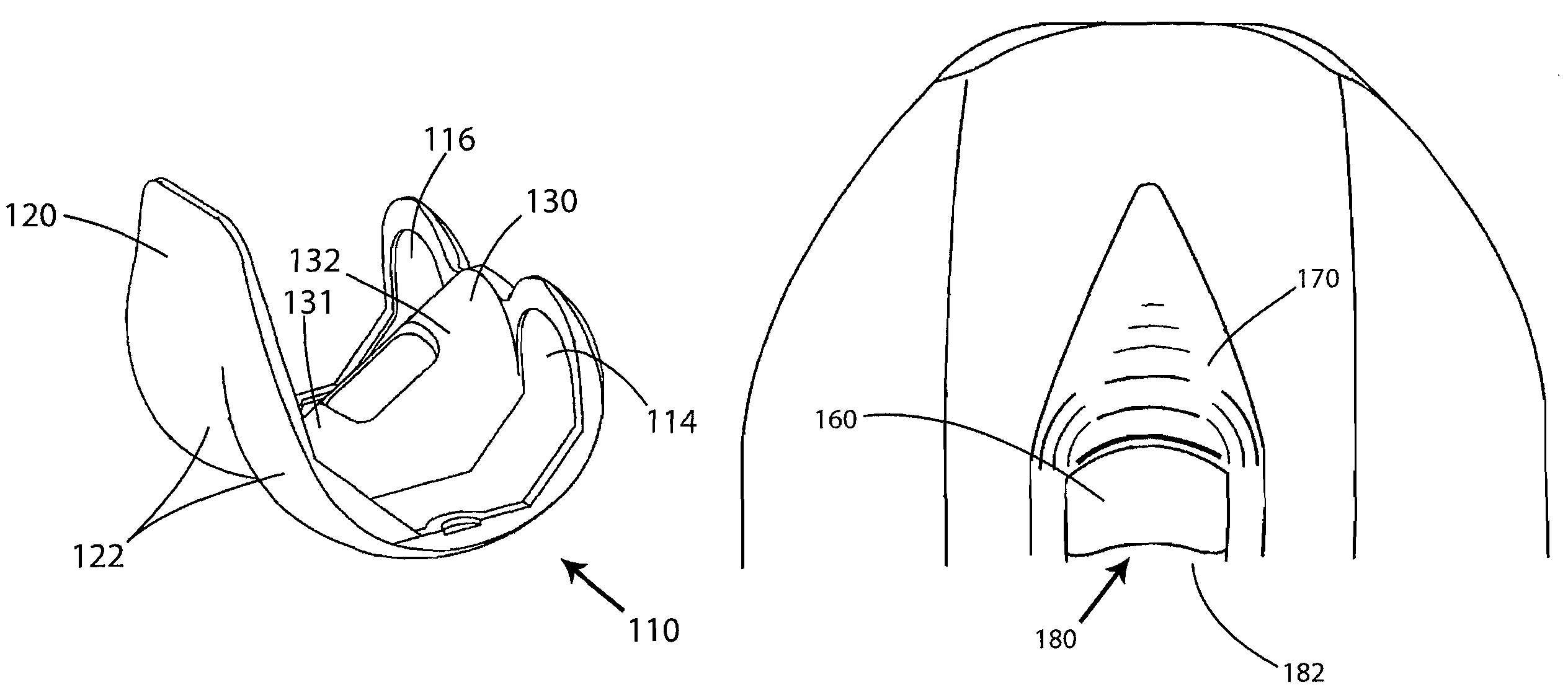 Posterior stabilized knee prosthesis