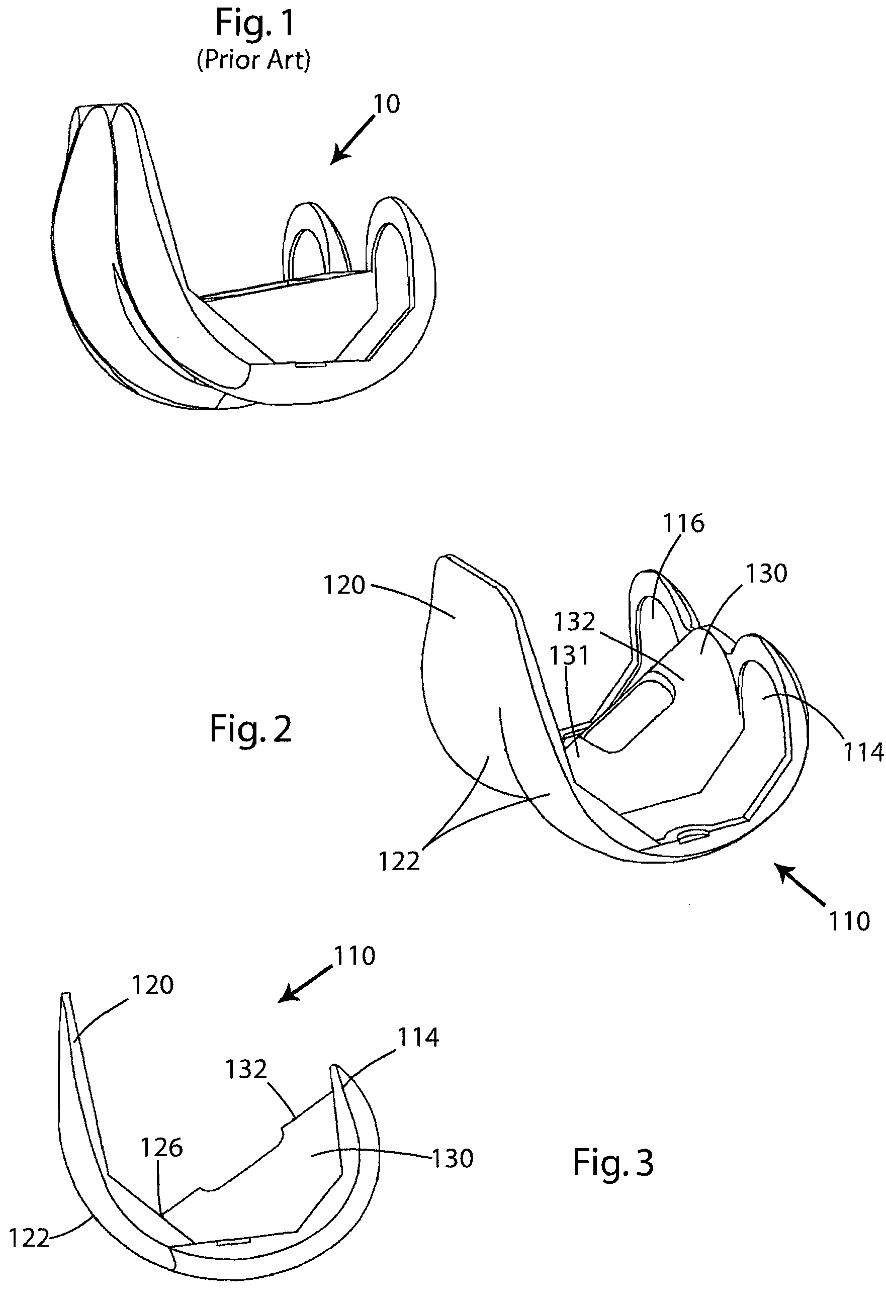 Posterior stabilized knee prosthesis