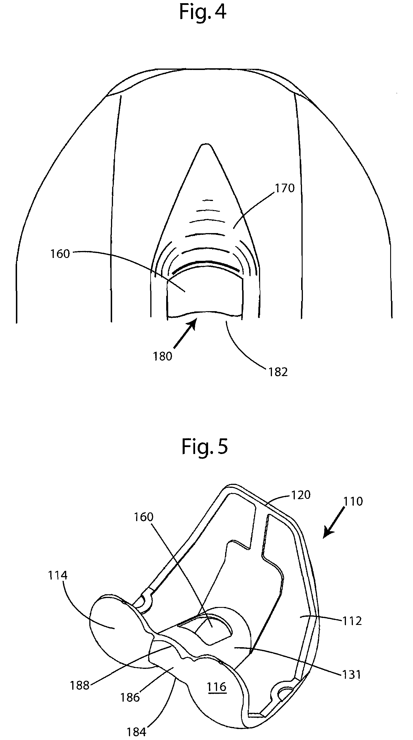 Posterior stabilized knee prosthesis