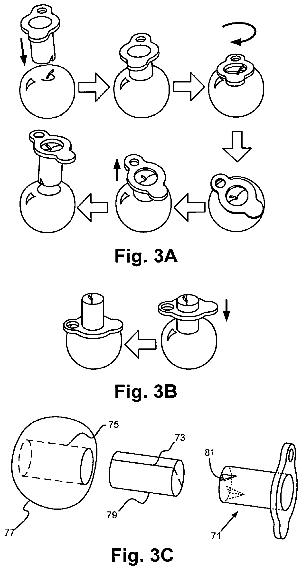 Fruit and vegetable coring system