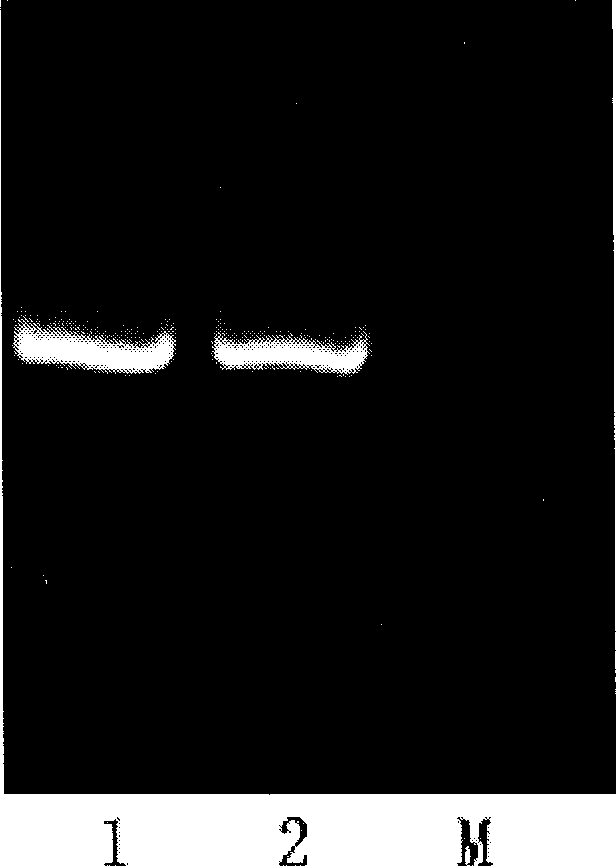 Recombinant Ag85B-Rv3425 bacillus Calmette-Guerin vaccine