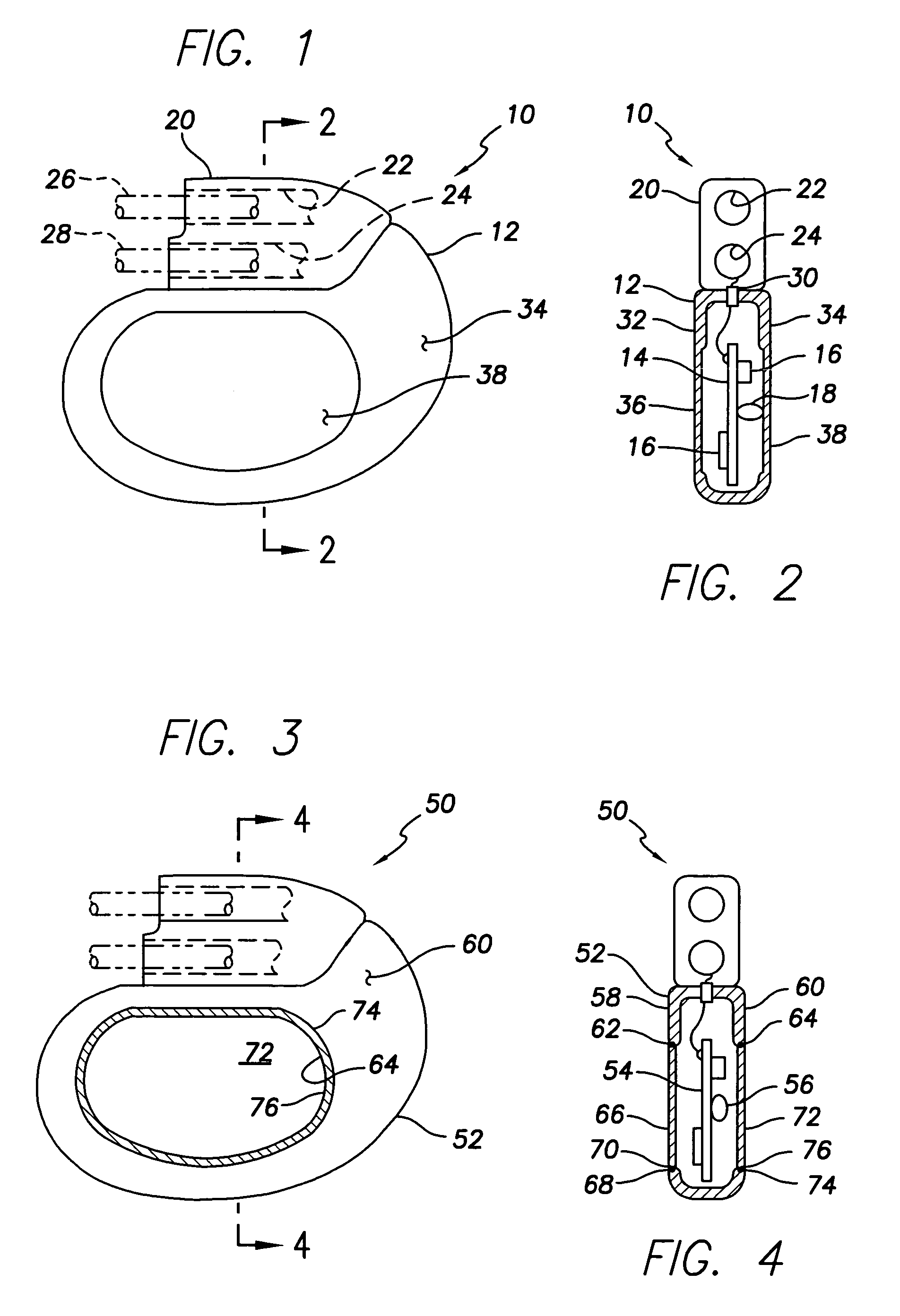 Implantable medical device having a casing providing high-speed telemetry