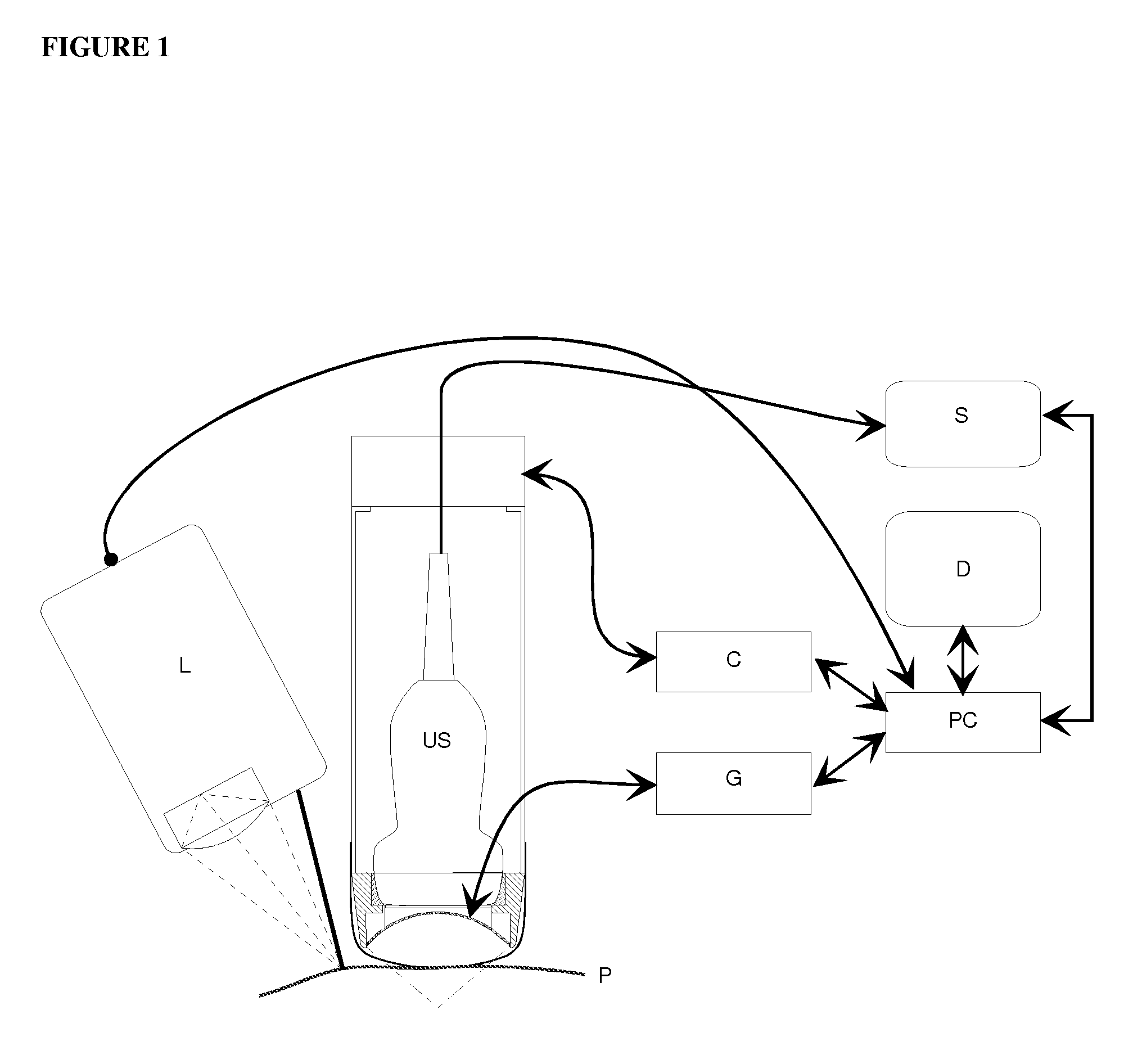 Systems and methods for synchronizing ultrasound treatment of thryoid and parathyroid with movements of patients