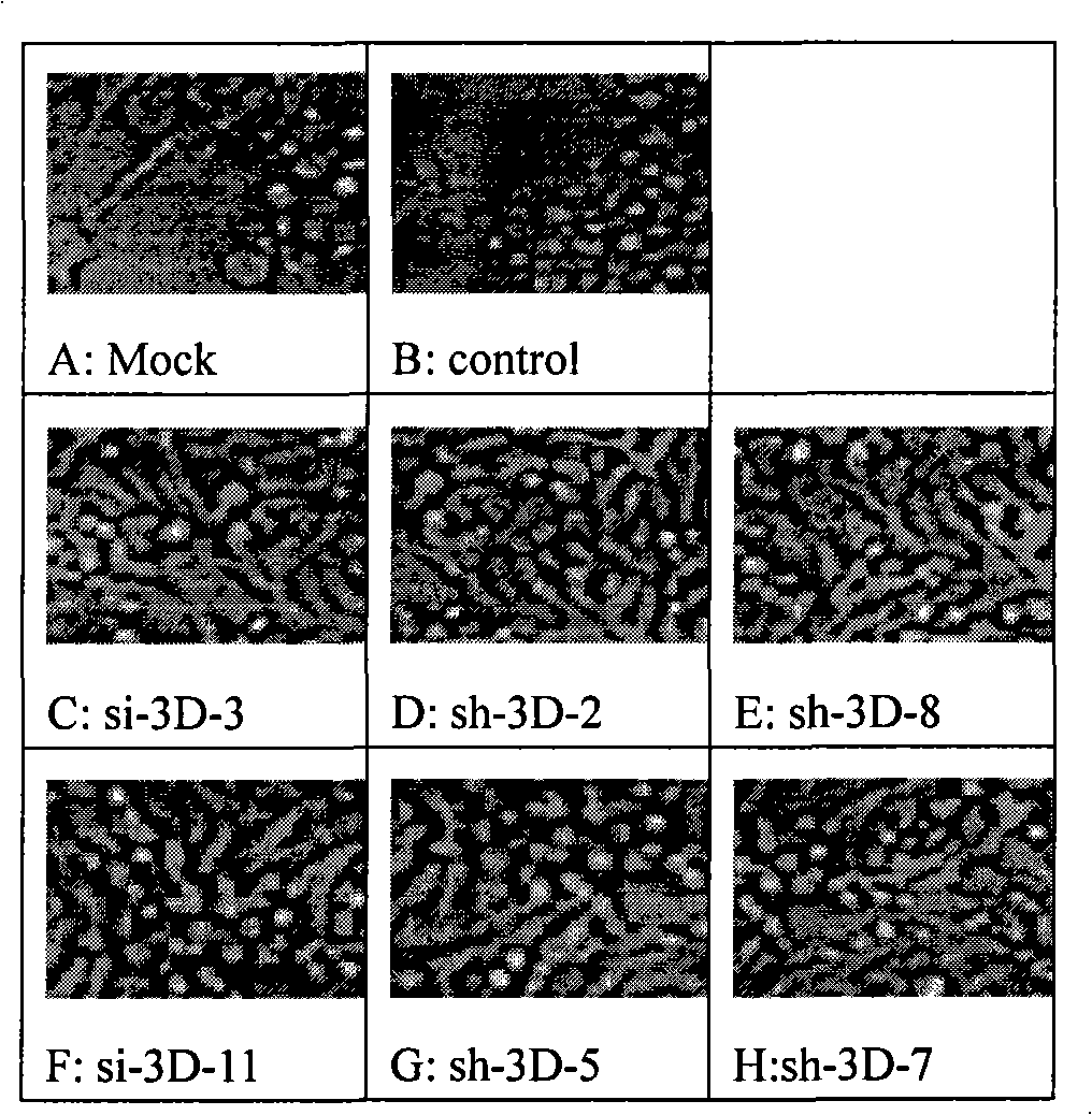 Spray containing small molecule disturbance ribonucleic acid