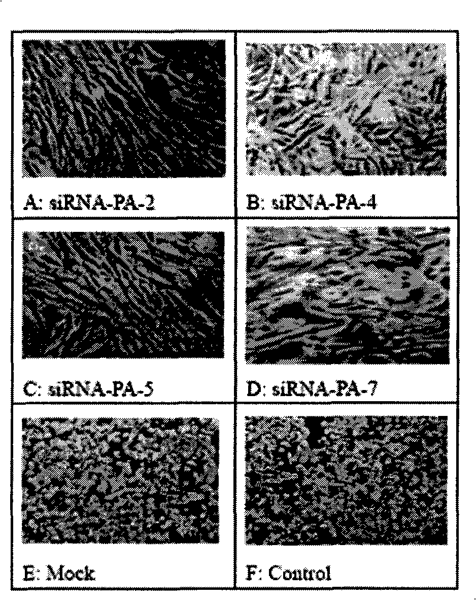 Spray containing small molecule disturbance ribonucleic acid