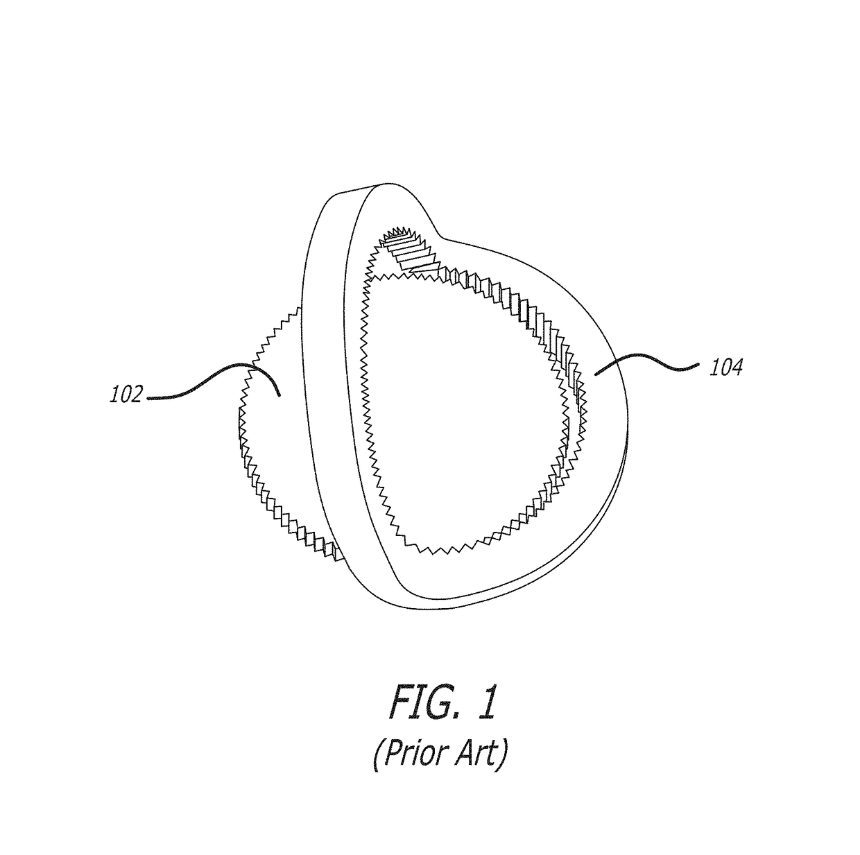 Systems and methods for fabricating structures including metallic glass-based materials using low pressure casting