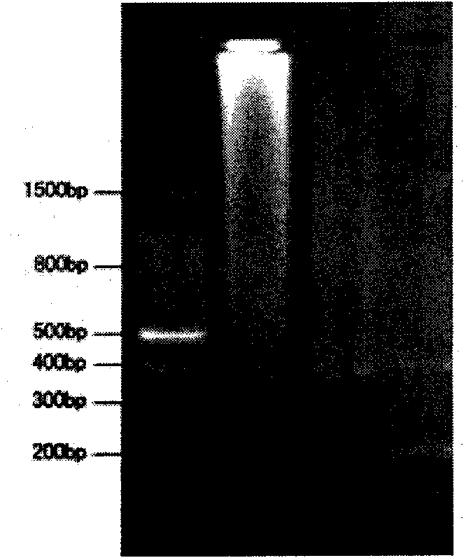 Primer for detecting dynamic mutation of CAG repetitive sequence of ATXN3 gene and PCR amplification method thereof