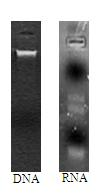 Extraction method of soil microbe genome DNA and total RNA