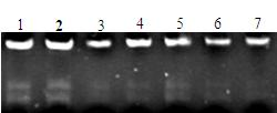 Extraction method of soil microbe genome DNA and total RNA