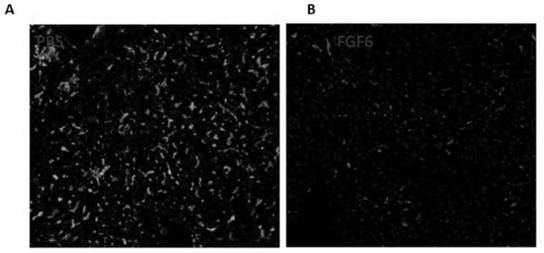 Application of fibroblast growth factor 6 in medicine for relieving non-alcoholic steatohepatitis liver injury